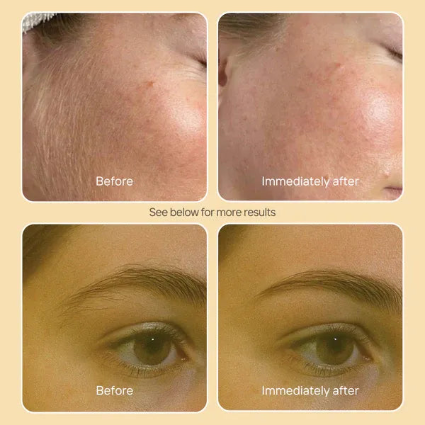 ScaOli Dermaplaning Tools